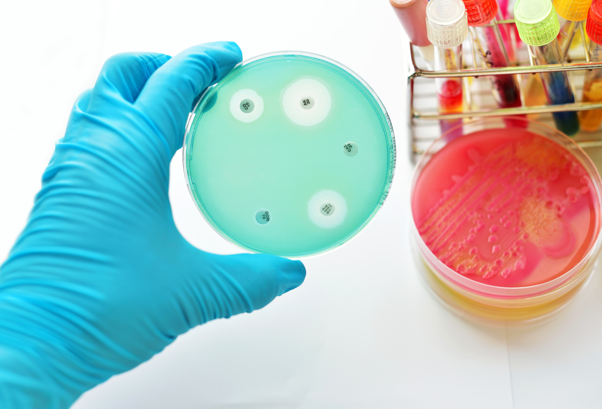 Vad innebär antibiotikaresistens?